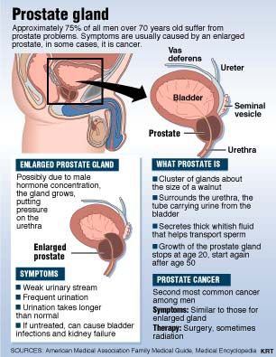 BPH is a non-cancerous enlargement of the prostate. Symptoms result when the enlargement squeezes the urethra where it runs through the prostate. BPH is the most common of prostate conditions among men; Prostatitis is an inflammation of the prostate. It is not contagious. It is sometimes caused by bacteria similar to those which cause other types of urinary infections; Prostate cancer is a malignant tumor that most often begins in the outer part of the prostate, but it may spread to the inner part.